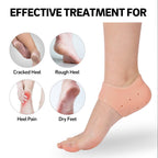 Silicone Gel Heel Socks – Cracked Heels Remedy | Velvet Wheels - 2