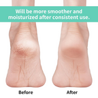 Silicone Gel Heel Socks – Cracked Heels Remedy | Velvet Wheels - 3