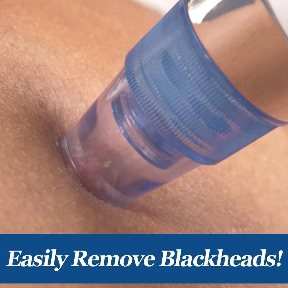 Blackhead Remover – 4-in-1 Vacuum Suction Pore Cleaner | ToolMate Pro - 5